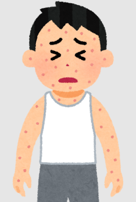 その皮疹、帯状疱疹かも!?放置すると目が見えなくなる可能性!?